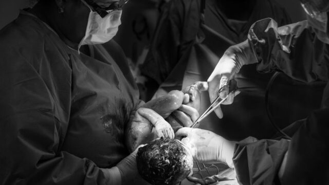 One in four births in England is now emergency caesarean, BBC analysis shows